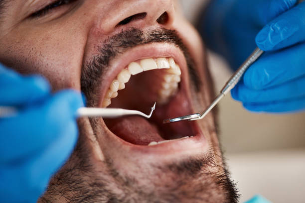 Best Oral Cancer Screening  in Des Plaines, IL